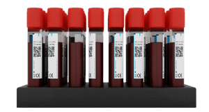 Blood plasma 1